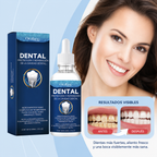 Gotas Protectoras Dentales - OralNova Dental Armor™